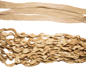 Intestines