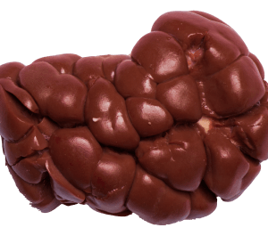 Kidney